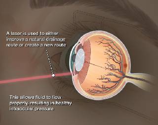 Glaucoma Treatment in Amanora, Amanora Park Town, Hadapsar